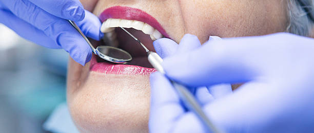 Best Emergency Dental Care for Sports Injuries in USA